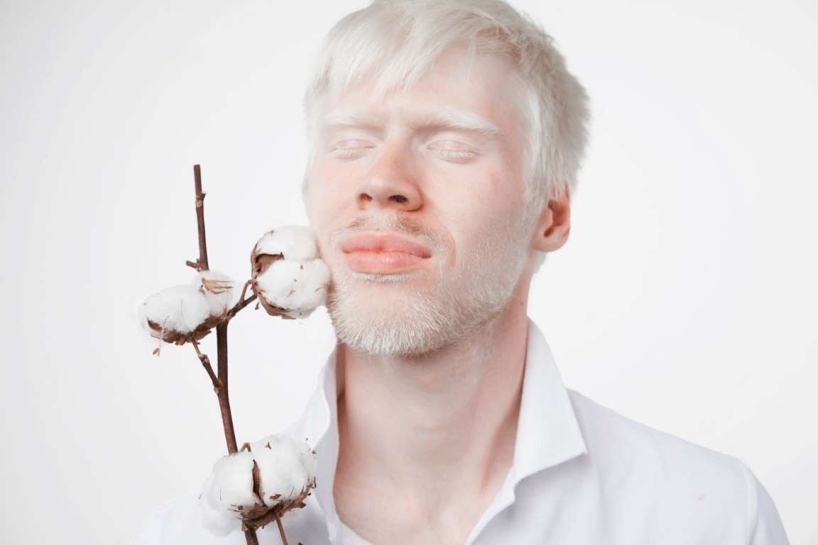 Albino rolf. Blog