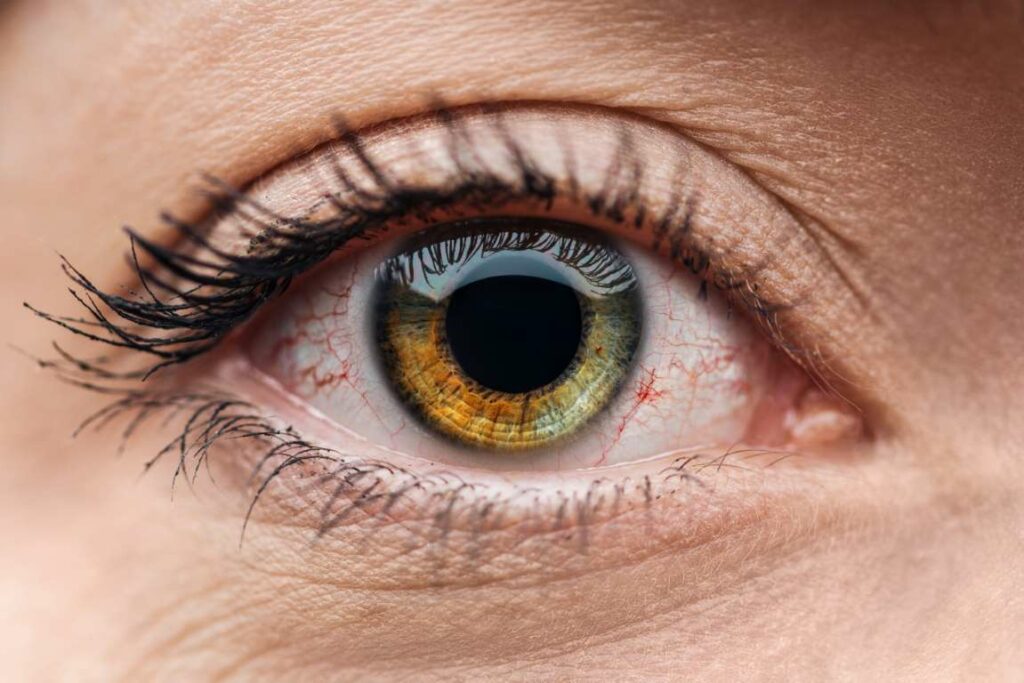 Rarest Eye Color  What is the rarest eye color in the world? - rolf. Blog